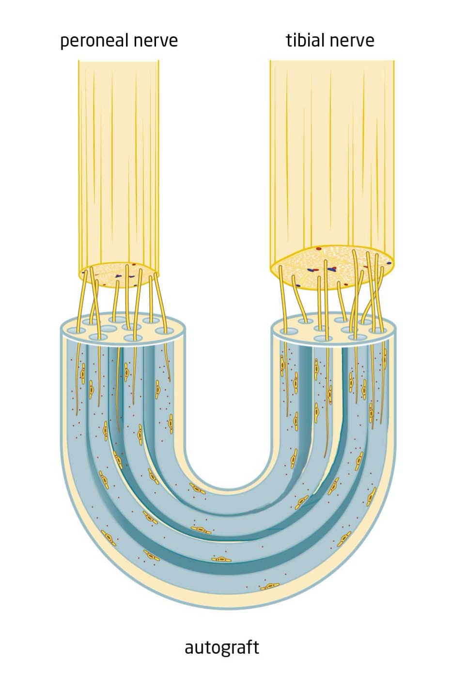 Figure schematic overview Centro-Central-Anastomosis, the basis for Atraxon concept